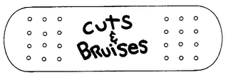CUTS & BRUISES