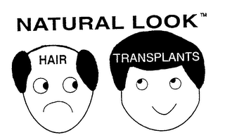 NATURAL LOOK HAIR TRANSPLANTS