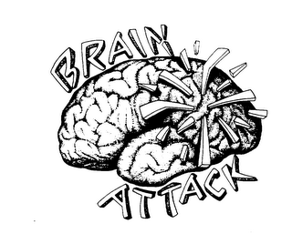 BRAIN ATTACK