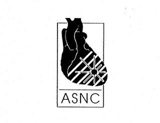 ASNC