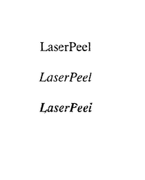 LASERPEEL