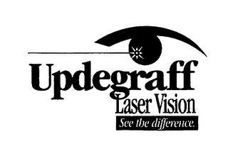 UPDEGRAFF LASER VISION SEE THE DIFFERENCE.