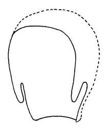 SHAPE OF CRANIAL ORTHOSIS BAND