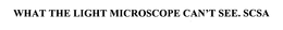 WHAT THE LIGHT MICROSCOPE CAN'T SEE. SCSA