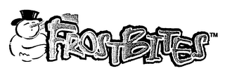 FROSTBITES