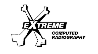 X EXTREME COMPUTED RADIOGRAPHY