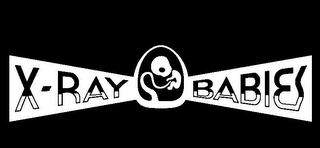X-RAY BABIES