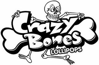 CRAZY BONES LOLLIPOPS