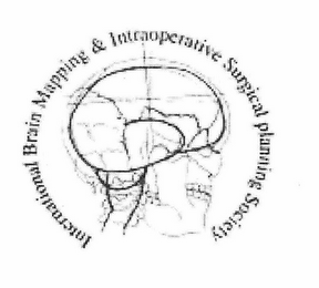 INTERNATIONAL BRAIN MAPPING & INTRAOPERATIVE SURGICAL PLANNING SOCIETY