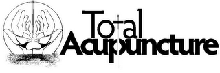 TOTAL ACUPUNCTURE