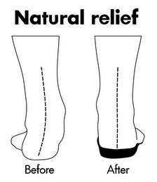 NATURAL RELIEF BEFORE AFTER