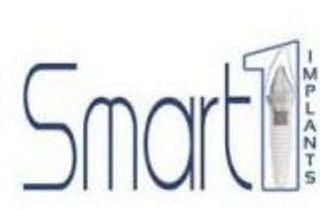 SMART1 IMPLANTS