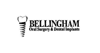 BELLINGHAM ORAL SURGERY & DENTAL IMPLANTS