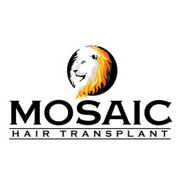 MOSAIC HAIR TRANSPLANT