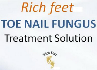 RICH FEET TOENAIL FUNGUS TREATMENT SOLUTION RICH FEET