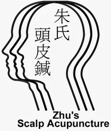 ZHU'S SCALP ACUPUNCTURE