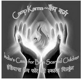 CAMP KARMA INDIA'S CAMP FOR BURN SCARRED CHILDREN