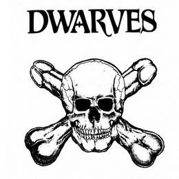 DWARVES