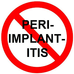 PERI-IMPLANT-ITIS