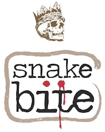 SNAKE BITE