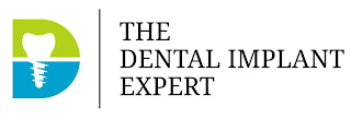 D THE DENTAL IMPLANT EXPERT