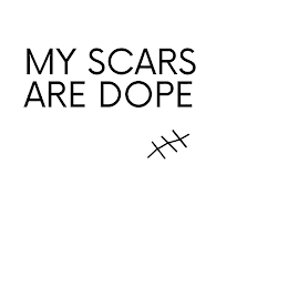 MY SCARS ARE DOPE