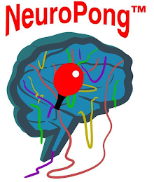 NEUROPONGTM