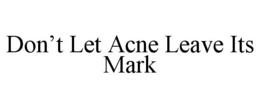 DON’T LET ACNE LEAVE ITS MARK